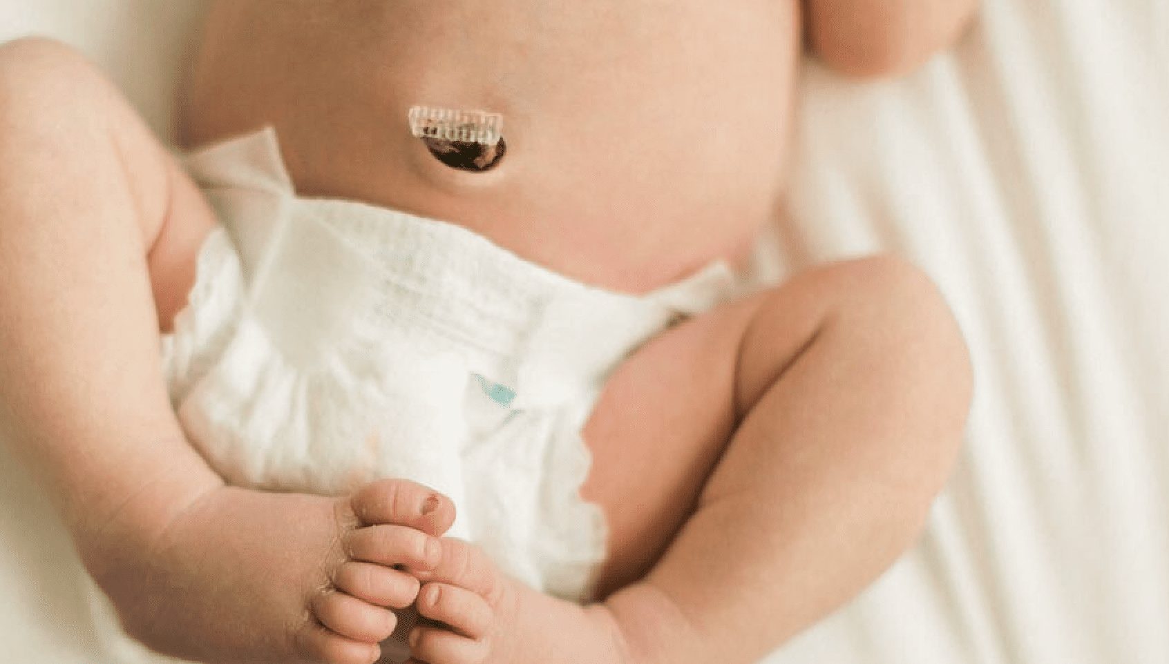 Umbilical Cord Care: The Simple Dos and Don'ts